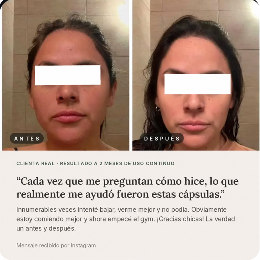 Rofarma | Ácido R-alfa lipoico 500 mg — Cápsulas blandas